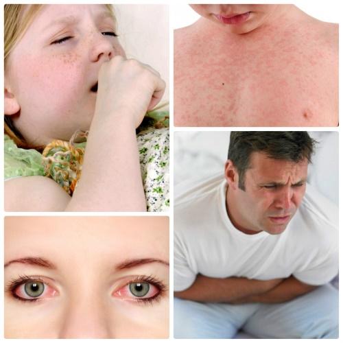 симптоми на алергия