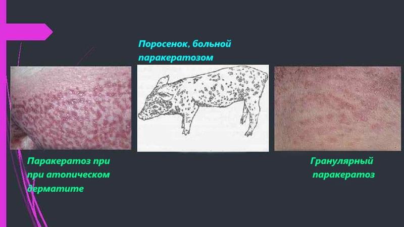 אבחון של parakeratosis בחזירים