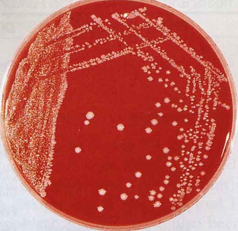 patogenní bakterie pasteurella